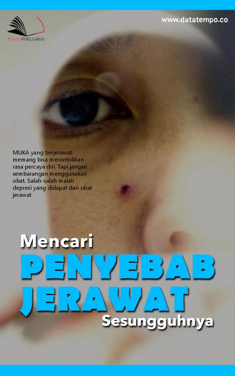 Mencari penyebab jerawat sesungguhnya