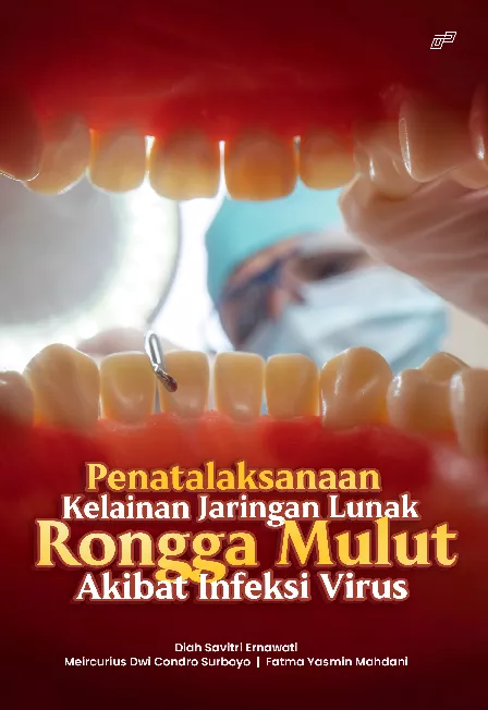 PENATALAKSANAAN KELAINAN JARINGAN LUNAK RONGGA MULUT AKIBAT INFEKSI VIRUS