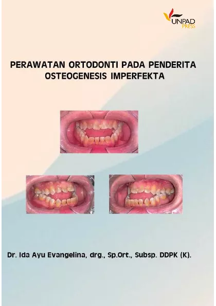 Perawatan Ortodonti Pada Penderita Osteogenesis Imperfekta