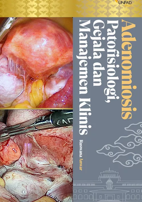 Adenomiosis Patofisiologi, Gejala, dan Manajemen Klinis