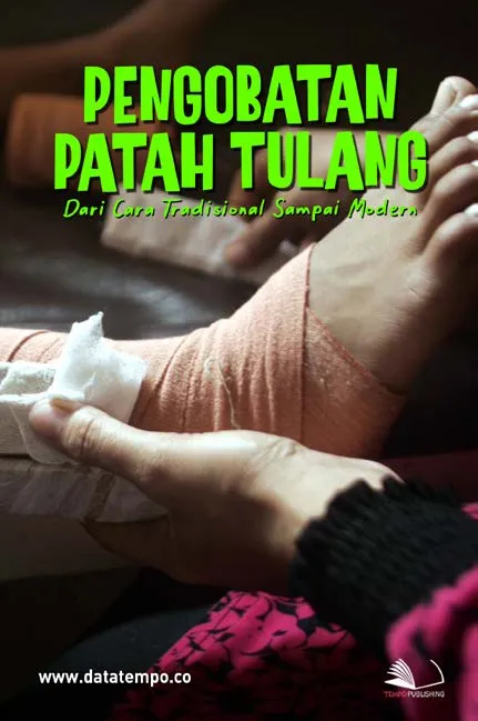Pengobatan Patah Tulang, Dari Cara Tradisional Sampai Modern