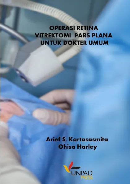 Operasi Retina Vitrektomi Pars Plana Untuk Dokter Umum