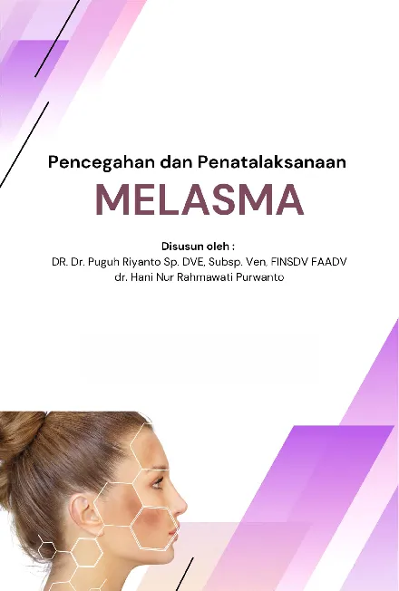 Pencegahan dan Penatalaksanaan Melasma