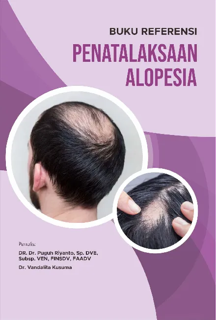 Buku Referensi Penatalaksanaan Alopesia