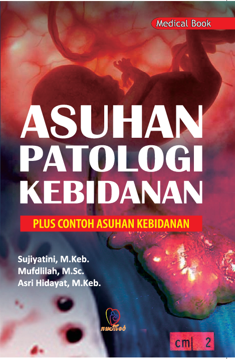 Asuhan Patologi Kebidanan : Plus Contoh Asuhan Kebidanan