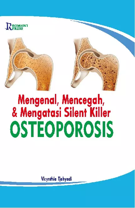 Mengenal, Mencegah, Mengatasi Silent Killer, “OSTEOPOROSIS”