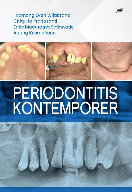 PERIODONTITIS KONTEMPORER