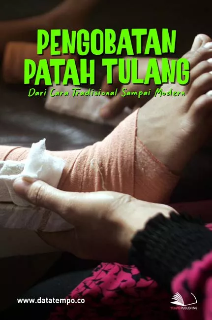 Pengobatan Patah Tulang, Dari Cara Tradisional Sampai Modern