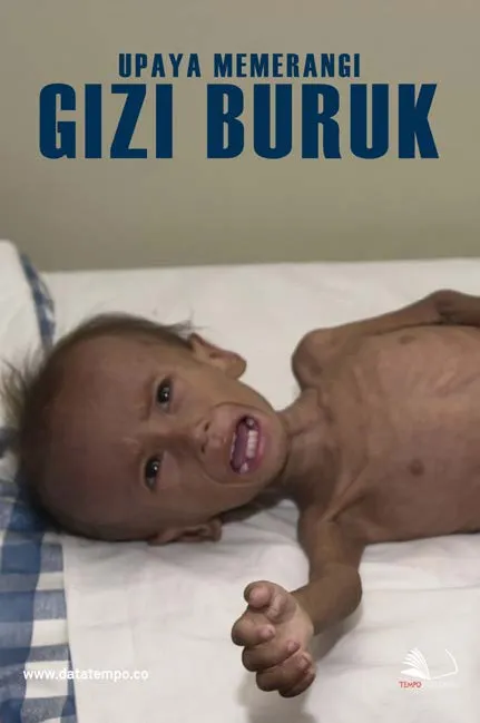 Upaya Memerangi Gizi Buruk