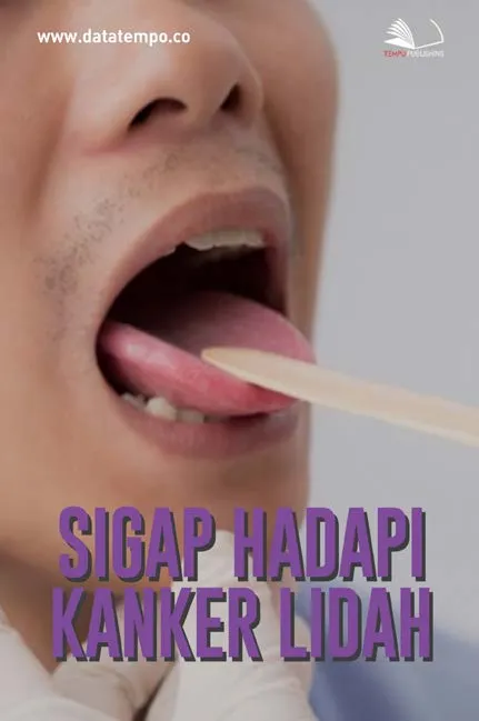 Sigap Hadapi Kanker Lidah