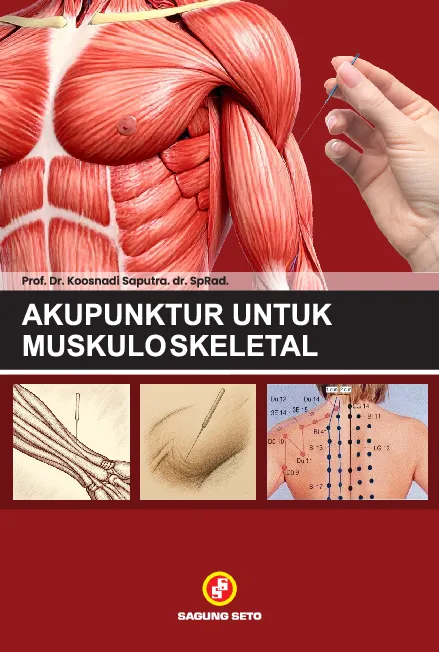 Akupunktur Untuk Muskuloskeletal