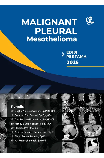 Malignant Pleural Mesothelioma