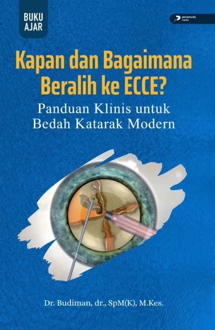 Kapan dan Bagaimana Beralih Ke Ecce? Panduan Klinis untuk Bedah Katarak Modern