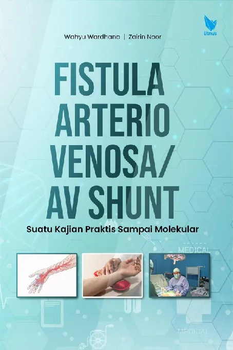 FISTULA ARTERIO VENOSA/AV SHUNT Suatu Kajian Praktis Sampai Molekular