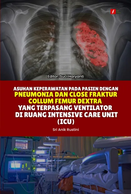 ASUHAN KEPERAWATAN PADA PASIEN DENGAN PNEUMONIA DAN CLOSE FRAKTUR COLLUM FEMUR DEXTRA YANG TERPASANG VENTILATOR DI RUANG INTENSIVE CARE UNIT (ICU)