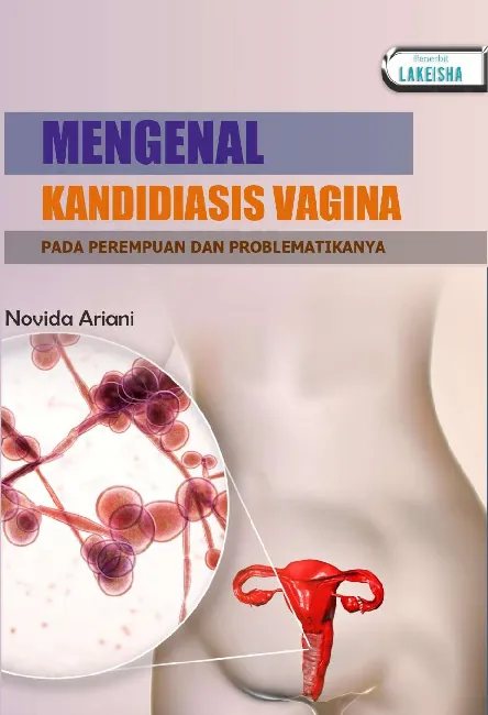 MENGENAL KANDIDIASIS VAGINA PADA PEREMPUAN DAN PROBLEMATIKANYA