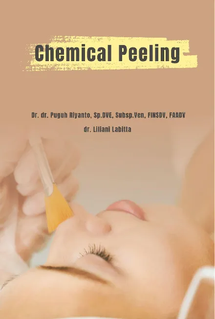 Chemical Peeling