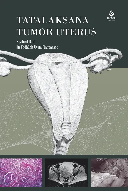 Tatalaksana Tumor Uterus