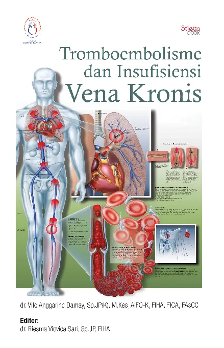 Tromboembolisme dan Insufisiensi Vena Kronis
