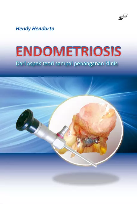 Endometriosis Dari Aspek Teori Sampai Penanganan Klinis