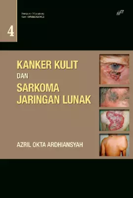 Kanker Kulit Dan Sarkoma Jaringan Lunak