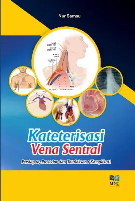 Kateterisasi Vena Sentral Persiapan, Prosedur dan Tatalaksana Komplikasi