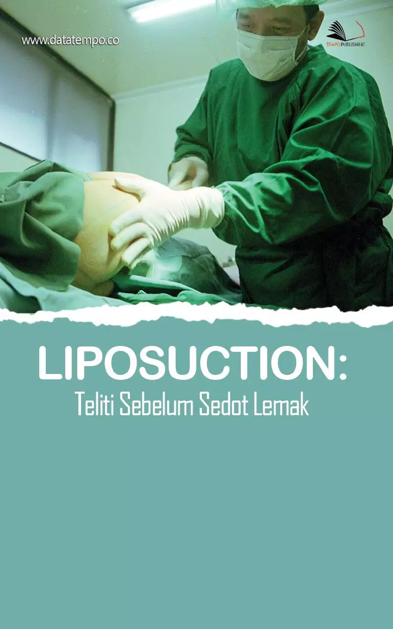 Liposuction: Teliti Sebelum Sedot Lemak