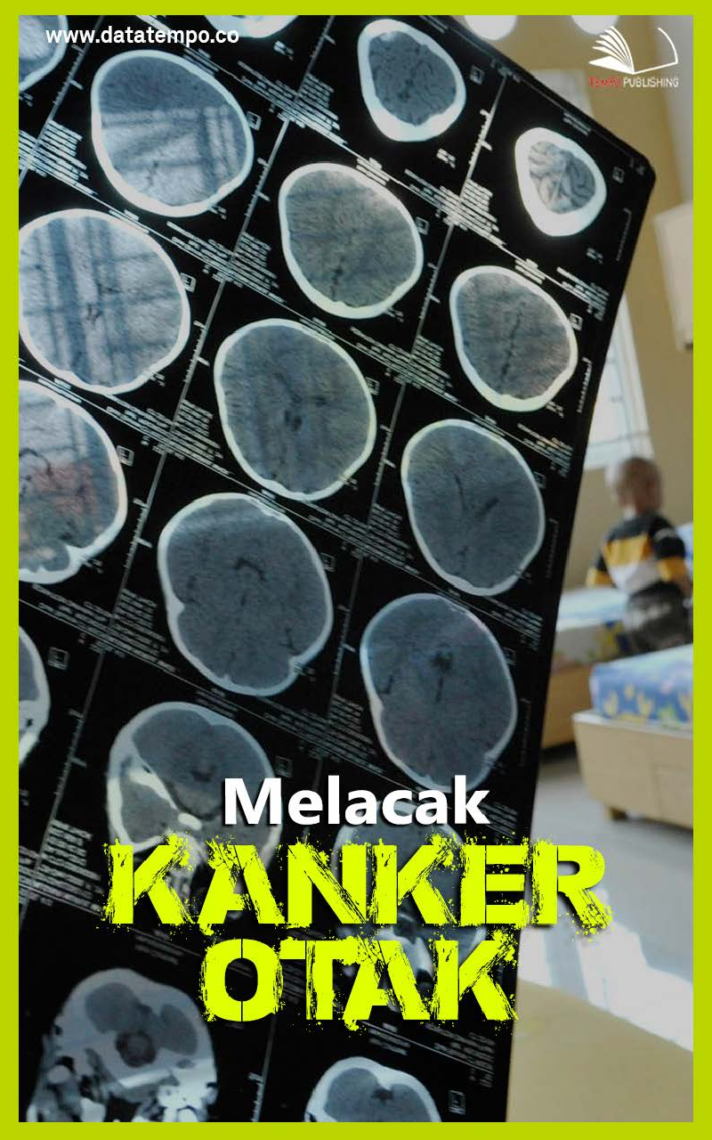 Melacak Kanker Otak