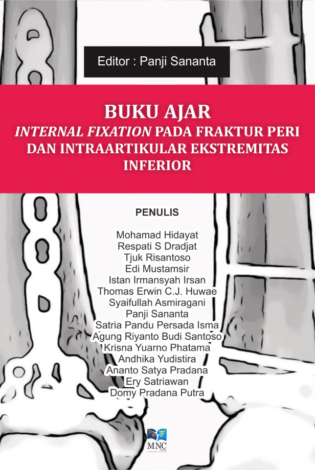 Buku Ajar Internal Fixation Pada Fraktur Peri dan Intraartikular Ekstremitas Inferior