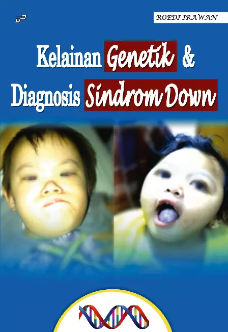 Kelainan Genetik dan Diagnosis Sindrom Down