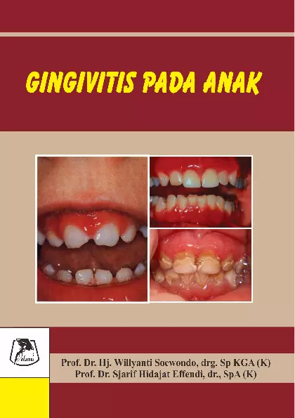 Gingivitis pada anak