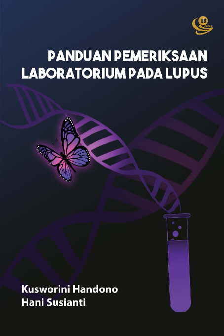 Panduan Pemeriksaan Laboratorium Lupus