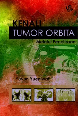 Kenali Tumor Orbita melalui Pencitraan