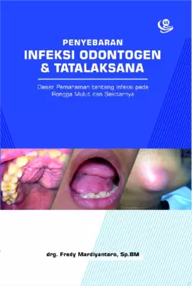 Penyebaran Infeksi Odontogen dan Tatalaksana: Dasar Pemahaman tentang Infeksi pada Rongga Mulut dan Sekitarnya