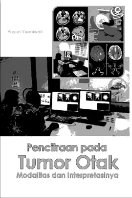 Pencitraan pada Tumor Otak