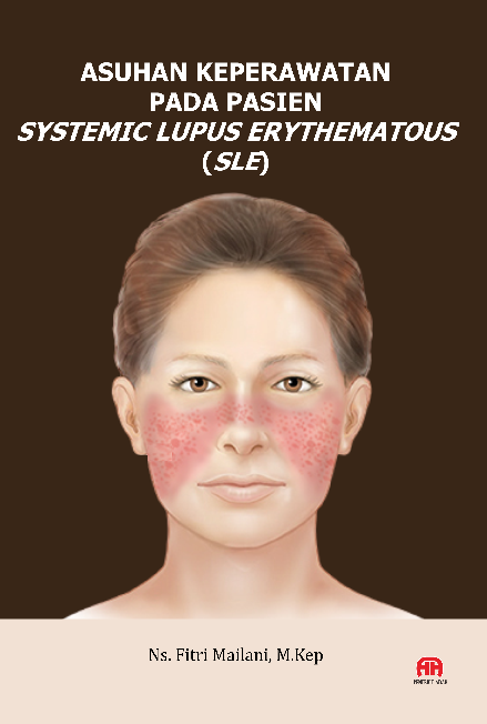 ASUHAN KEPERAWATAN PADA PASIEN SYSTEMIC LUPUS ERYTHEMATOUS (SLE)