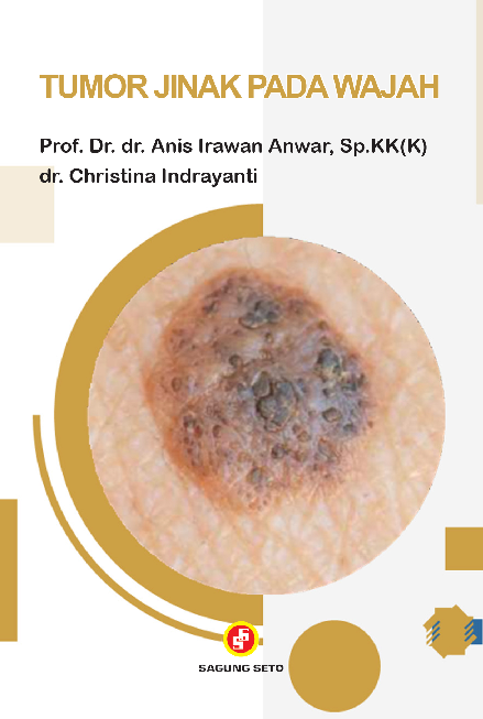 Tumor Jinak Pada Wajah