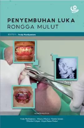 Penyembuhan Luka Rongga Mulut