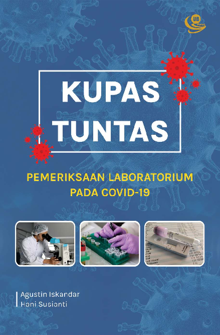 Kupas Tuntas Pemeriksaan Laboratorium pada COVID-19