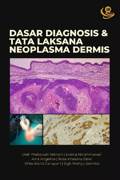 Dasar Diagnosis dan Tata Laksana Neoplasma Dermis