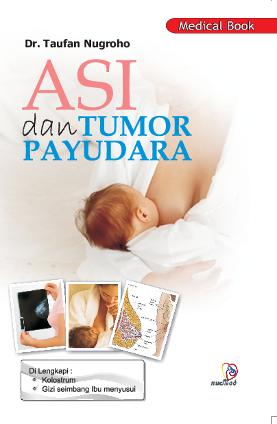 Asi dan Tumor Payudara