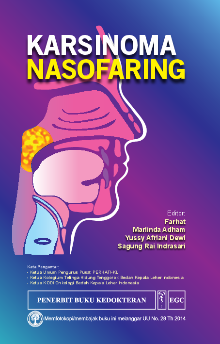 Karsinoma Nasofaring 