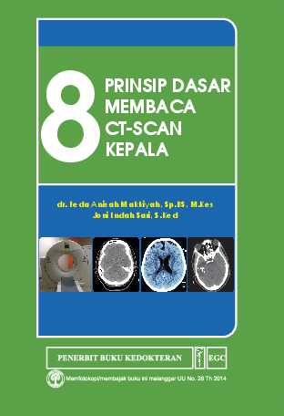 8 Prinsip Dasar Membaca CT-Scan Kepala