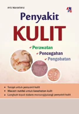 Penyakit Kulit , Perawatan,Pencegahan ,Pengobatan