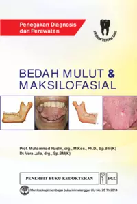 Bedah mulut & maksilofasial : penegakan diagnosis dan perawatan