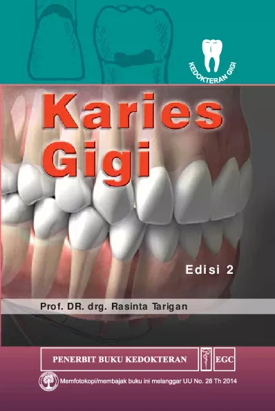 Karies Gigi Edisi 2