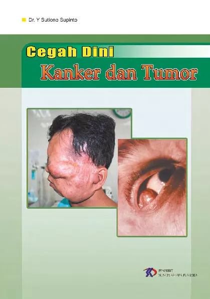 Cegah Dini Tumor dan Kanker