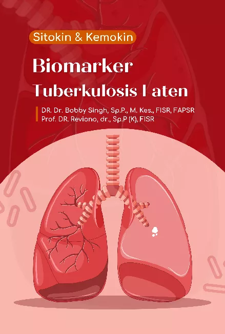 Sitokin dan kemokin biomarker tuberkulosis laten