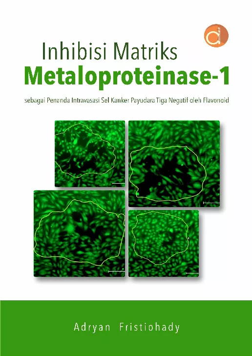 Inhibisi Matriks Metaloproteinase-1 sebagai Penanda Intravasasi Sel Kanker Payudara Tiga Negatif oleh Flavonoid