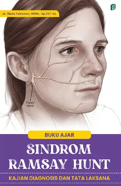 Buku Ajar Sindrom Ramsay Hunt : Kajian Diagnosis dan Tata Laksana